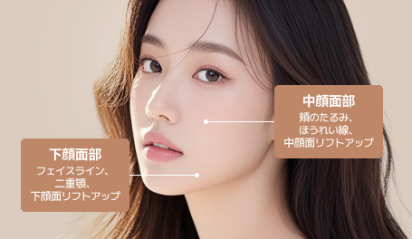 内視鏡ミニリフト